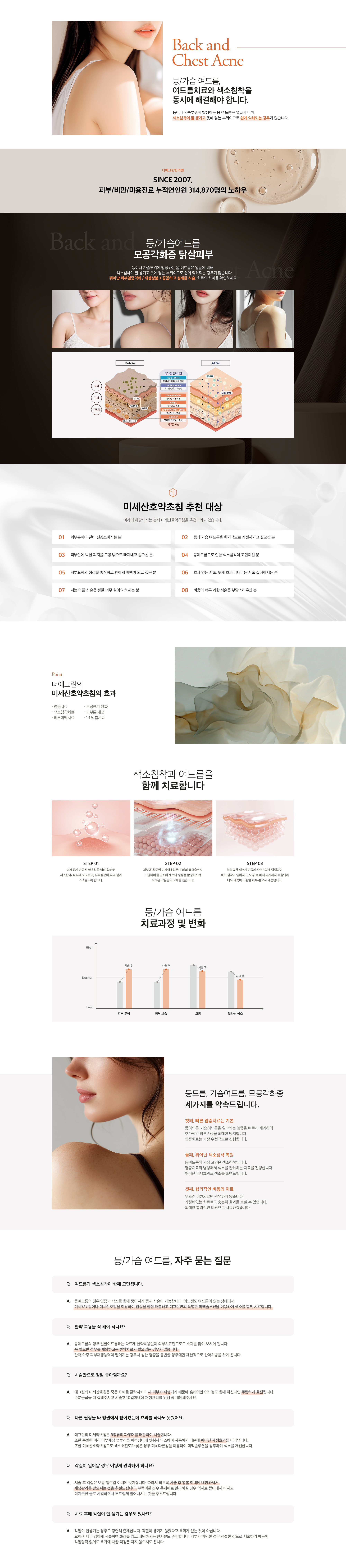 등/가슴 여드름